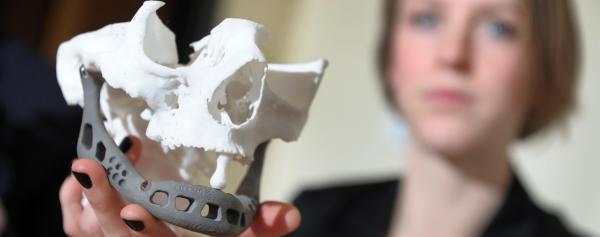 Een 83-jarige vrouw kreeg een 3D-geprinte onderkaak geïmplanteerd