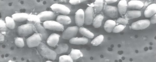 GFAJ-1 (arsenicumbacterie)
