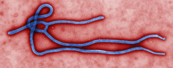 Ebolavirus