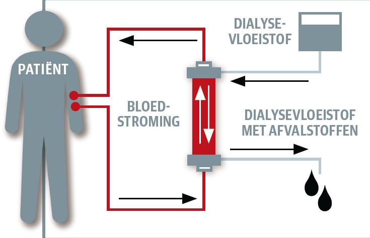 Drie manieren om bloed te zuiveren - KIJK Magazine