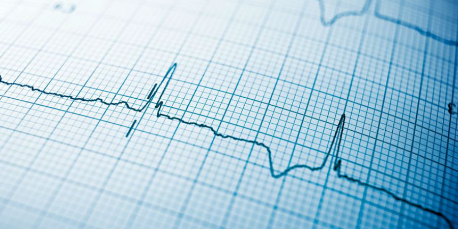 boezemfibrilleren hart