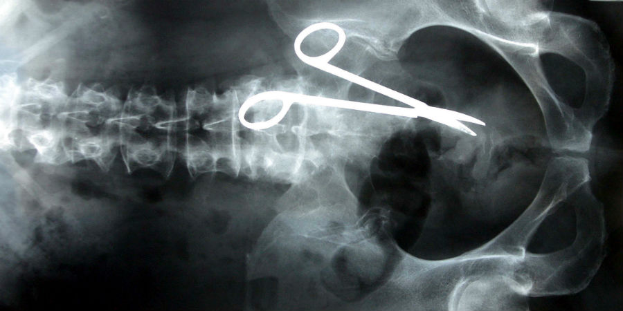 röntgenfoto