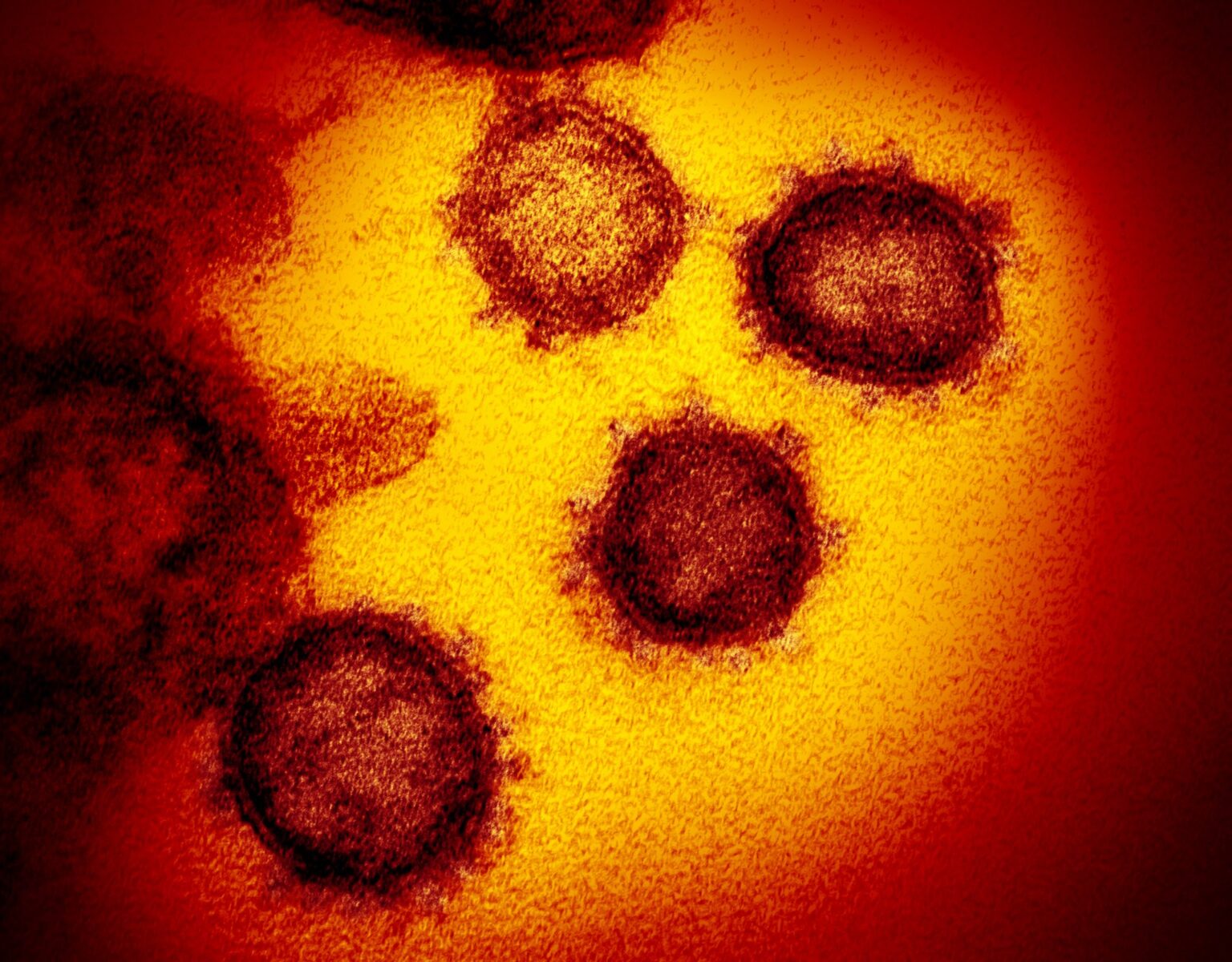 Zo ziet het coronavirus eruit - KIJK Magazine