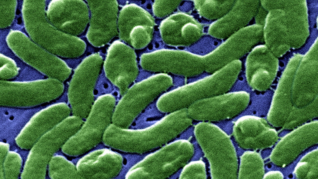 Microscoopafbeelding van V. vulnificus bacterie