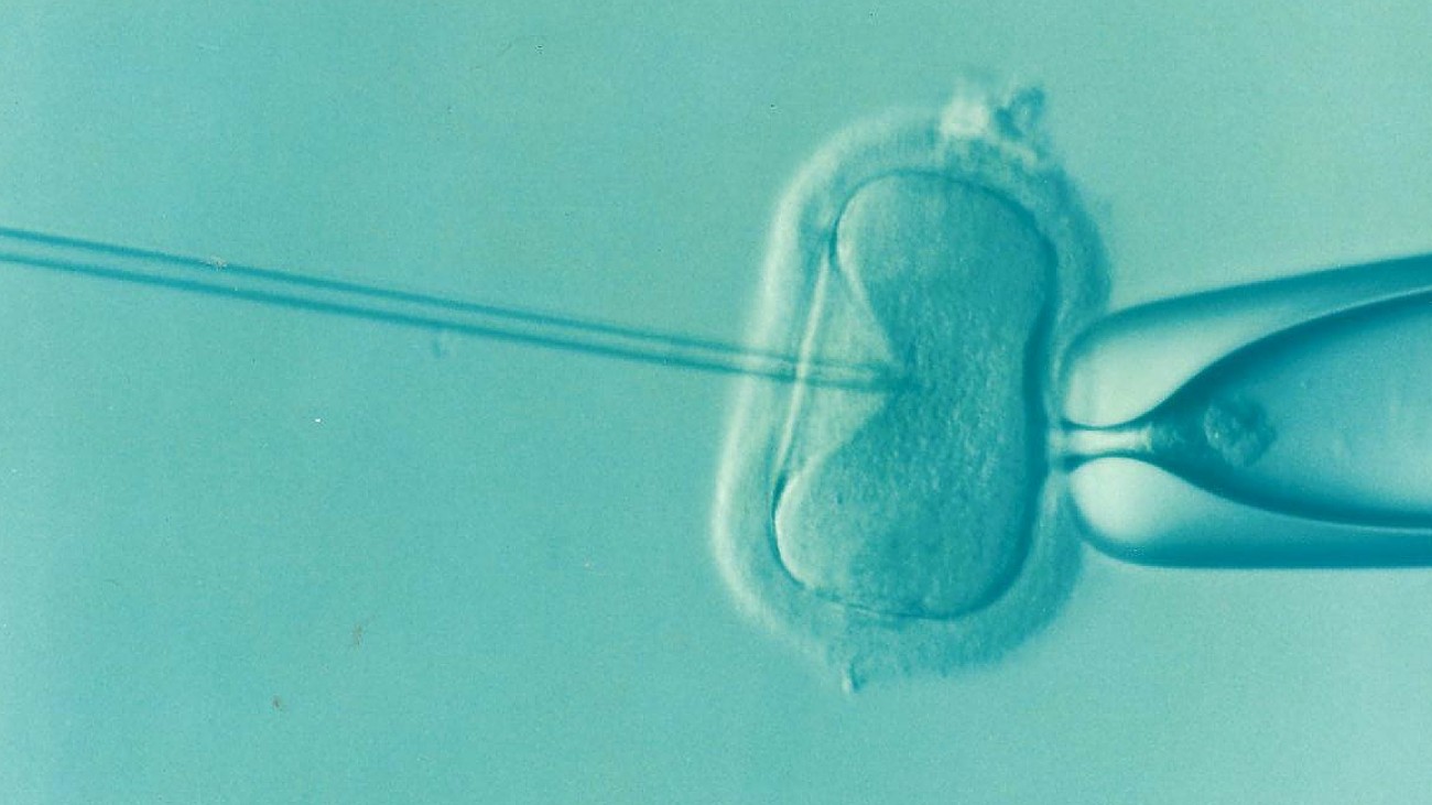 Door mitochondriale donatie kan een kind drie biologische ouders hebben.