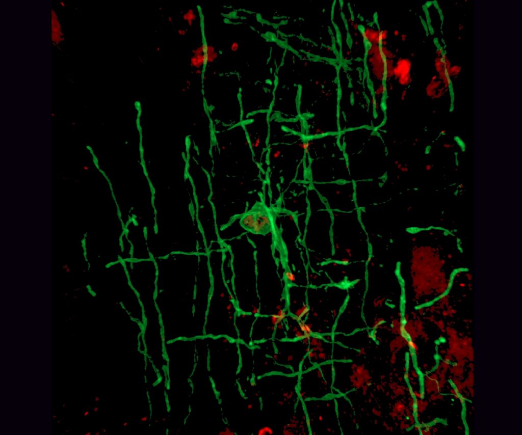 Een oligodendrocyt onder de microscoop met myeline in groen zichtbaar