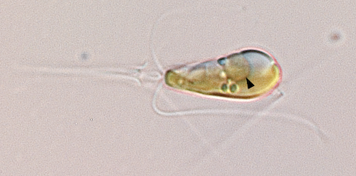 De alg Braarudosphaera bigelowii heeft 
de bacterie UCYN-A opgeslokt en omgetoverd tot organel, dat fenomeen heet endosymbiose.