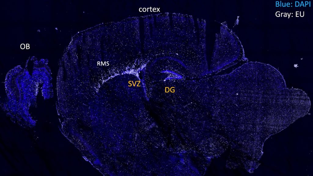 Het RNA (lichtpaars) en DNA (donkerpaars) zichtbaar op een microscoopfoto van de hersenen van een 1-jarige muis. 