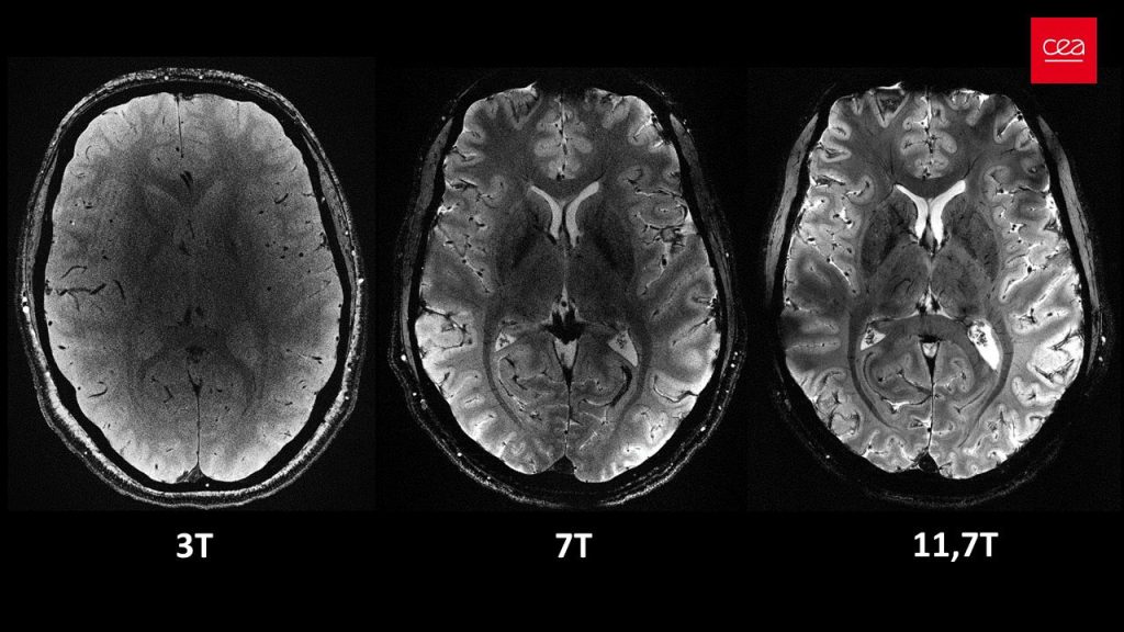 MRI-scans van een brein met verschillende kracht. De Iseult-scanner toont duidelijk de meeste details. 