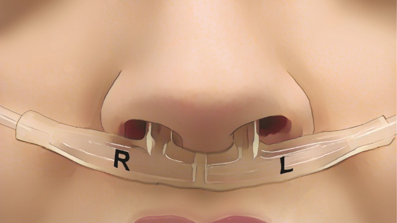 illustratie van apparaat dat ademhalingspatronen meet