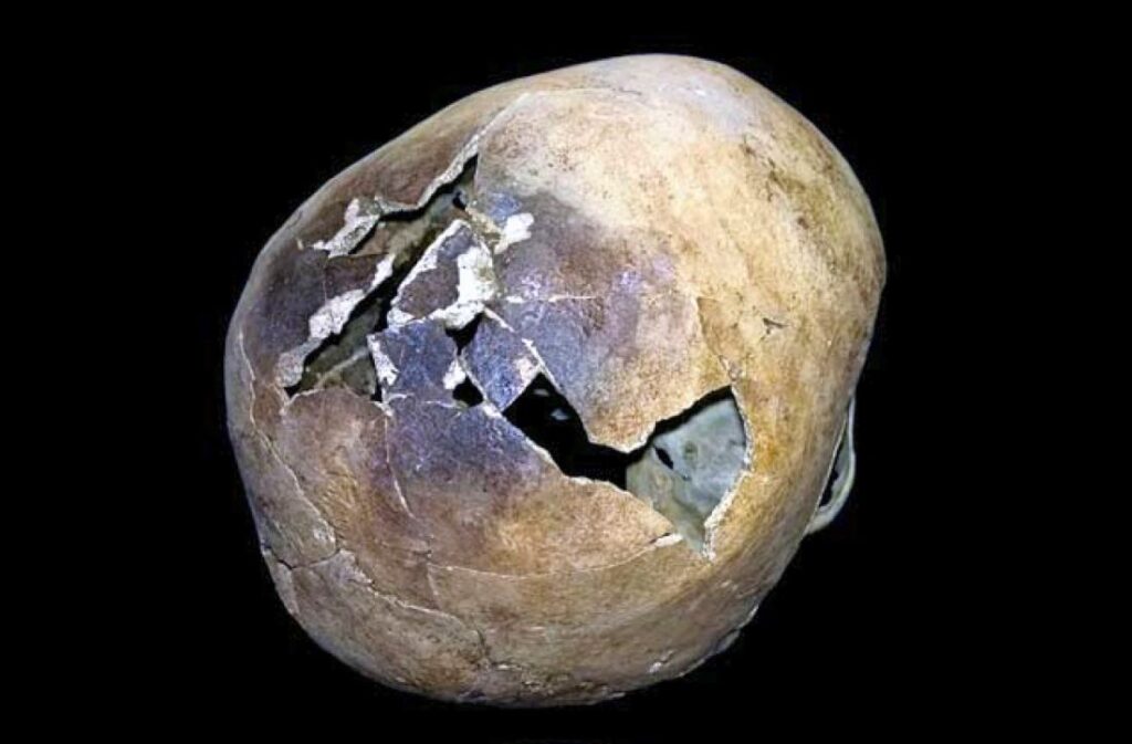 gebarsten schedel van slachtoffer van de vesuvius