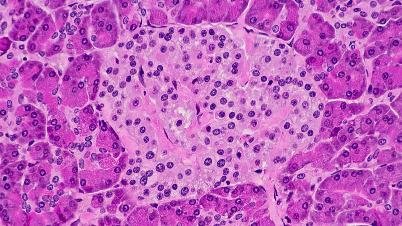 eilandjes van langerhans die het hormoon insuline produceren