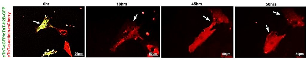 Microscopenfoto's van delende hartspiercel