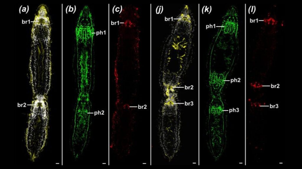 Microscopische foto's van deling platworm