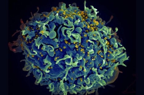 hiv dat immuuncel probeert binnen te dringen