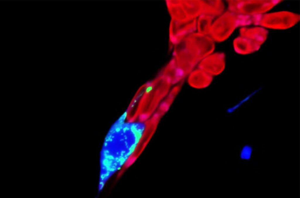 Sommige mitochondriën (groen) zijn vanuit een zenuwcel (blauw) naar aangrenzende kankercellen (rood) verplaatst.