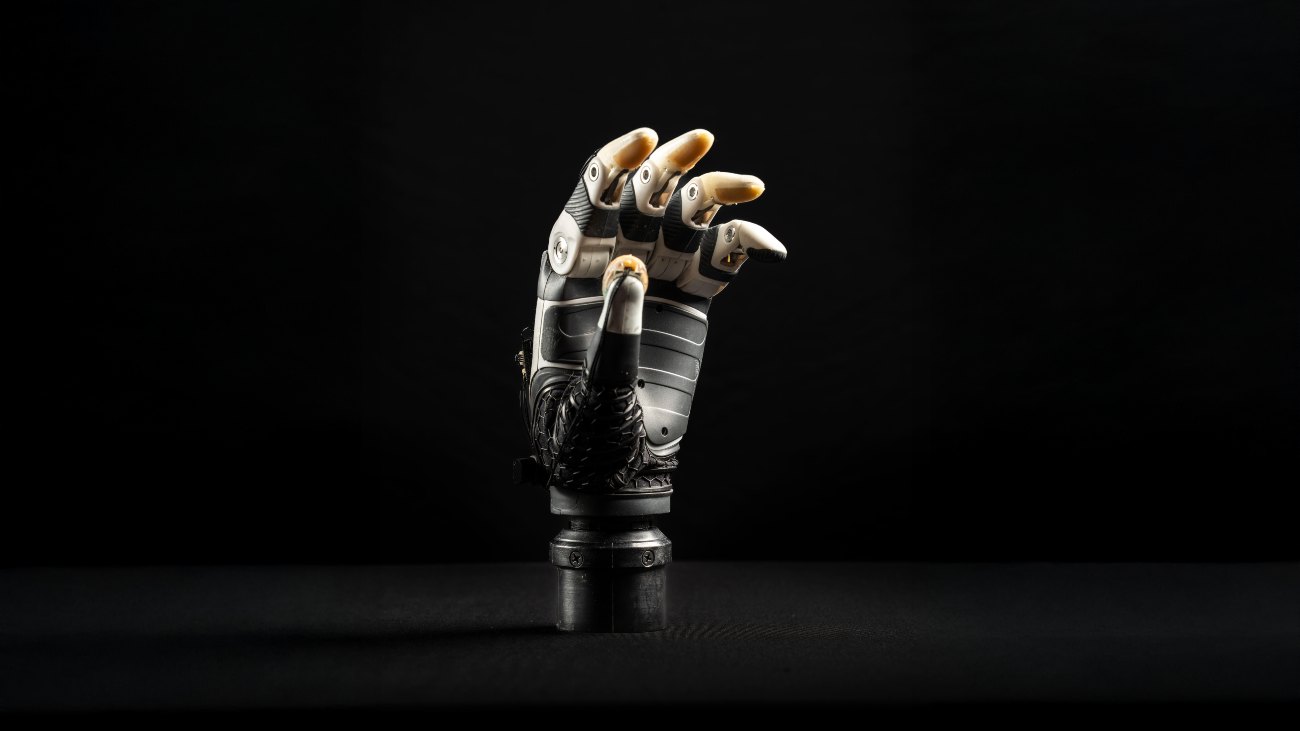 robotische handprothese