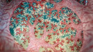 Close-up van bloemkoolkoraal winnaar van CUPOTY