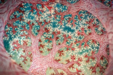 Close-up van bloemkoolkoraal winnaar van CUPOTY