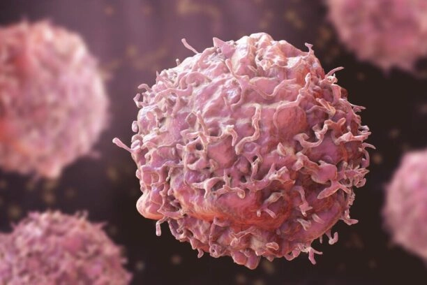 Illustratie van kanker cellen