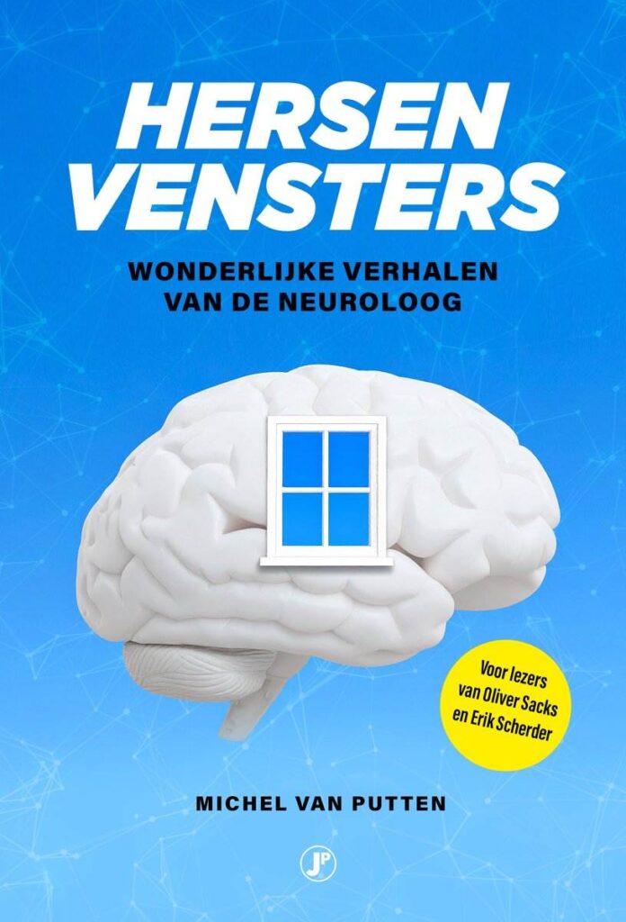 Omslag van Hersenvensters