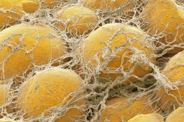 Microscopische foto van vetcellen in vetweefsel