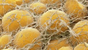 Microscopische foto van vetcellen in vetweefsel