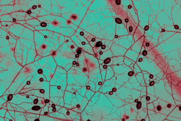 Draden van een wortelschimmel onder de microscoop