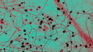 Draden van een wortelschimmel onder de microscoop