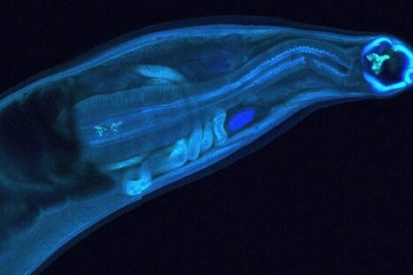 microscopische foto van een mijnworm