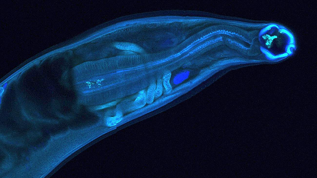 microscopische foto van een mijnworm