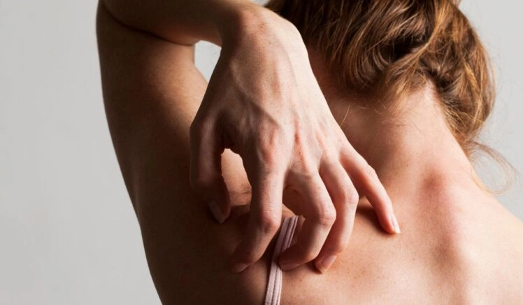 vrouw krabt haar rug vanwege chronische jeuk