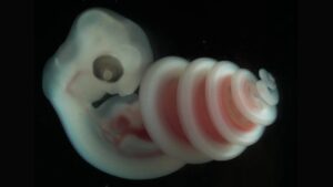 slangenembryo waarbij duidelijk te zien is dat het embryo een spiraal vormt