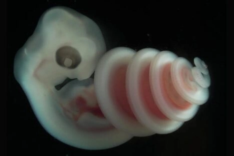 slangenembryo waarbij duidelijk te zien is dat het embryo een spiraal vormt