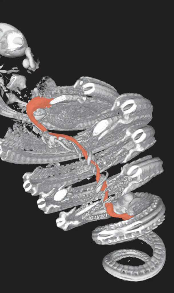 De oranje streng op deze CT-scan is de darm van een ontwikkelend slangenembryo.